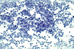 Non-Gyn Smear Pap Stain 40x