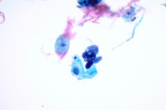 ThinPrep Pap test 40x