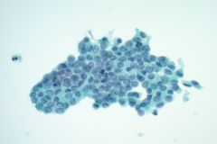 ThinPrep® Non-Gyn slide 40x
