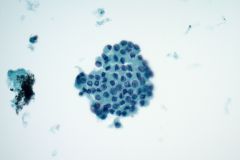 ThinPrep® Non-Gyn slide 40x