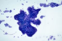 Modified Romanowsky Stain Smear, 10x