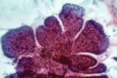 Pap Stain Smear, 20x