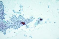 Pap Stain Smear, 20x