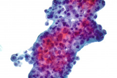 ThinPrep® Non-Gyn 40x