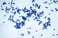 Smear-Pap-Stain-40x
