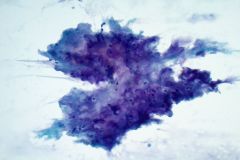 Pap stain Smear, 20x