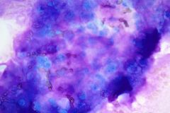  Modified Romanowsky stain  Smear, 40x
