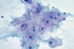 Pap stain Smear, 40x