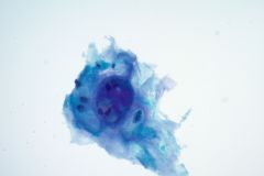 ThinPrep® Non-Gyn slide 40x