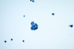 ThinPrep® Non-Gyn slide 40x