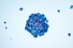 ThinPrep® Non-Gyn slide 40x