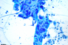 Non-Gyn smear Pap stain 40x