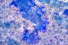 Modified Romanowsky Smear, 20x