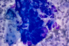 Modified Romanowsky Smear, 40x