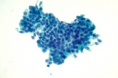 ThinPrep Non Gyn slide, 40x