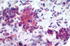Non-Gyn Smear Pap Stain  40x