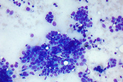 Smear, Modified Romanowsky (Diff Quik), 20x