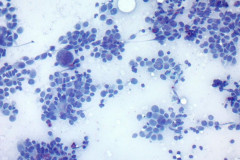 Smear, Pap Stain, 20x