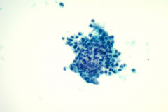 Nocardia-ThinPrep-400x